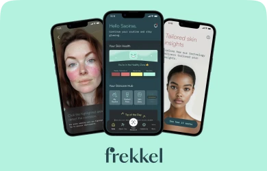 Frekkel Application